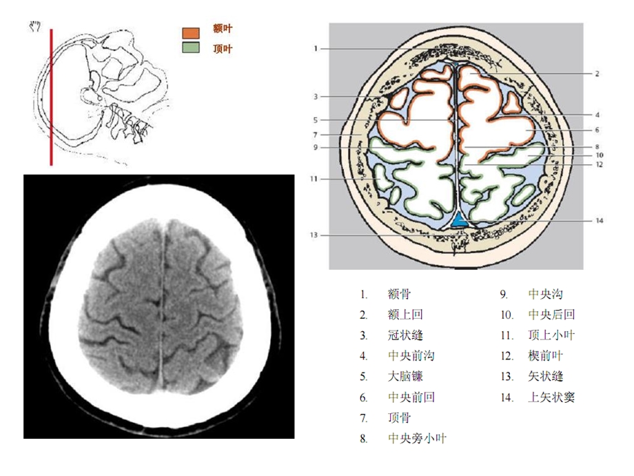 头颈CT-MRI解剖图解第一季.ppt_第2页
