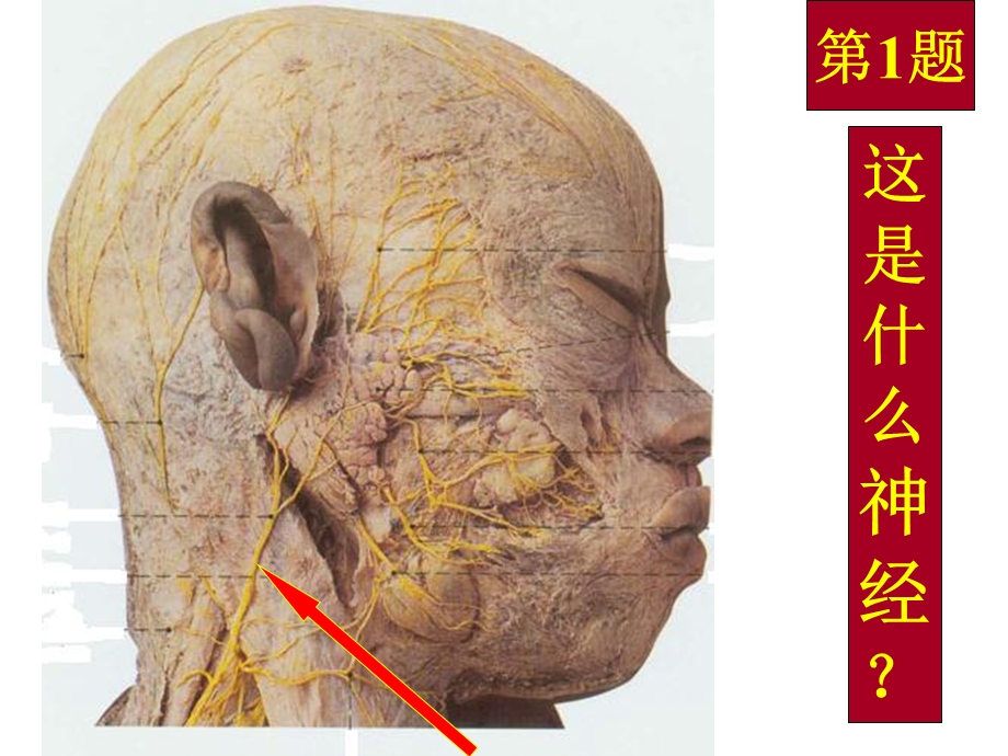 局部解剖标本考试01共.ppt_第3页