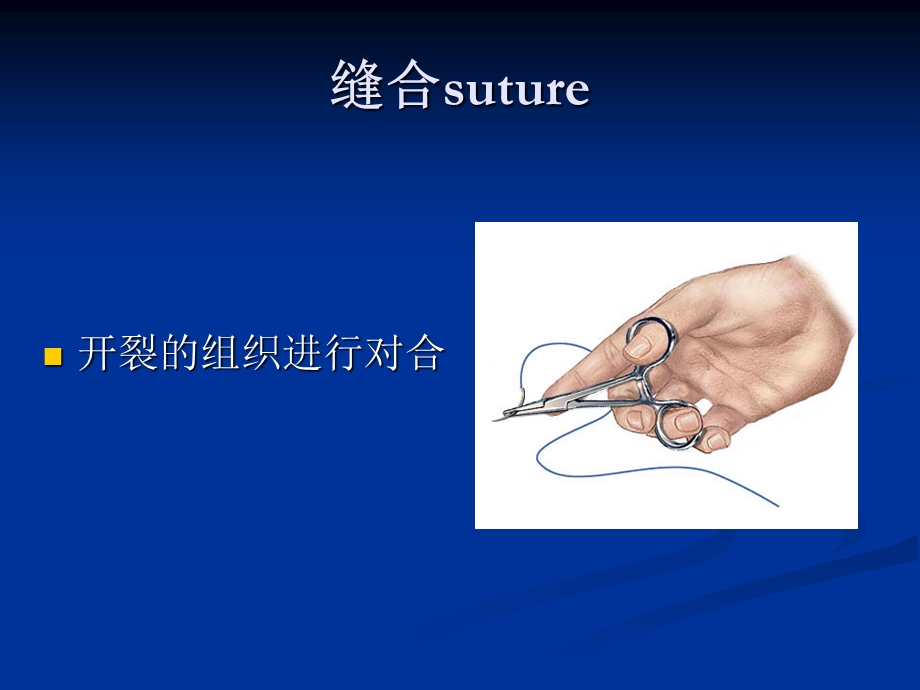 外科常用吻合和缝合技术.ppt_第2页