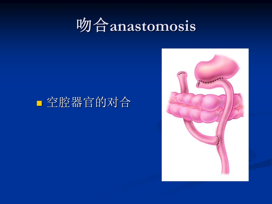 外科常用吻合和缝合技术.ppt_第3页