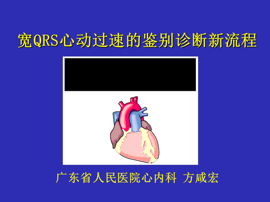 宽QRS波心动过速鉴别诊断.ppt_第1页