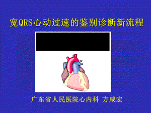 宽QRS波心动过速鉴别诊断.ppt