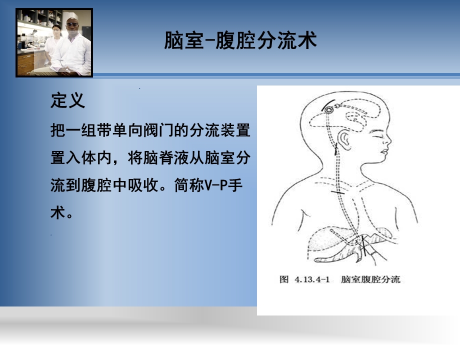 室腹腔分流术护理查房.ppt_第2页