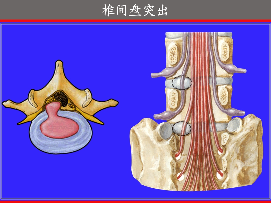 实验5关节一躯干骨、上肢骨的连接.ppt_第3页