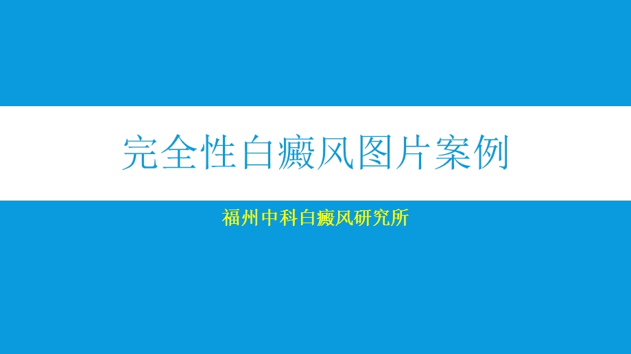 完全性白癜风图片案例.ppt_第1页