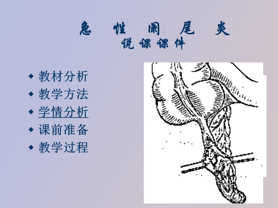 急性阑尾炎说.ppt_第2页