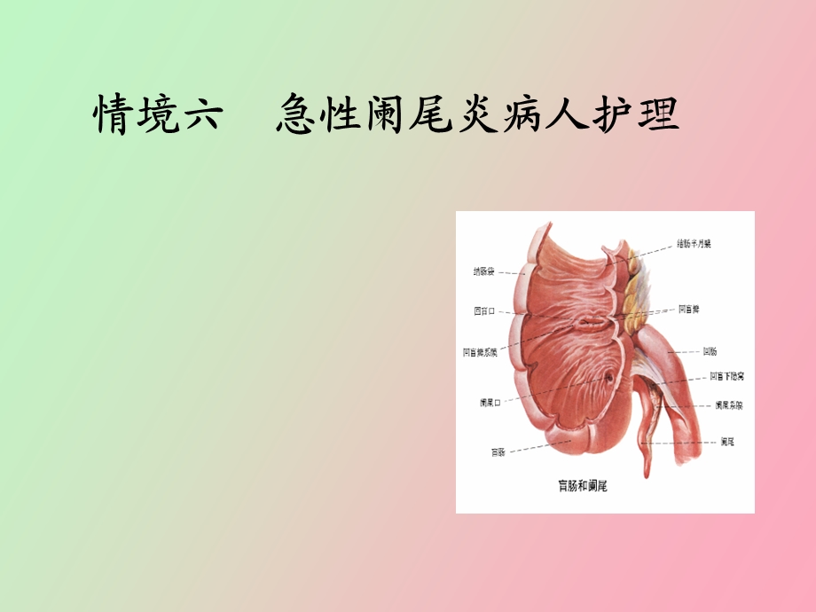 急性阑尾炎实训.ppt_第1页