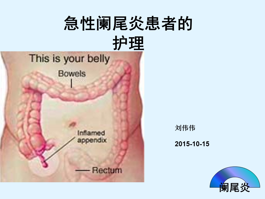 急性阑尾炎患者的护理-PPT课件.ppt_第1页