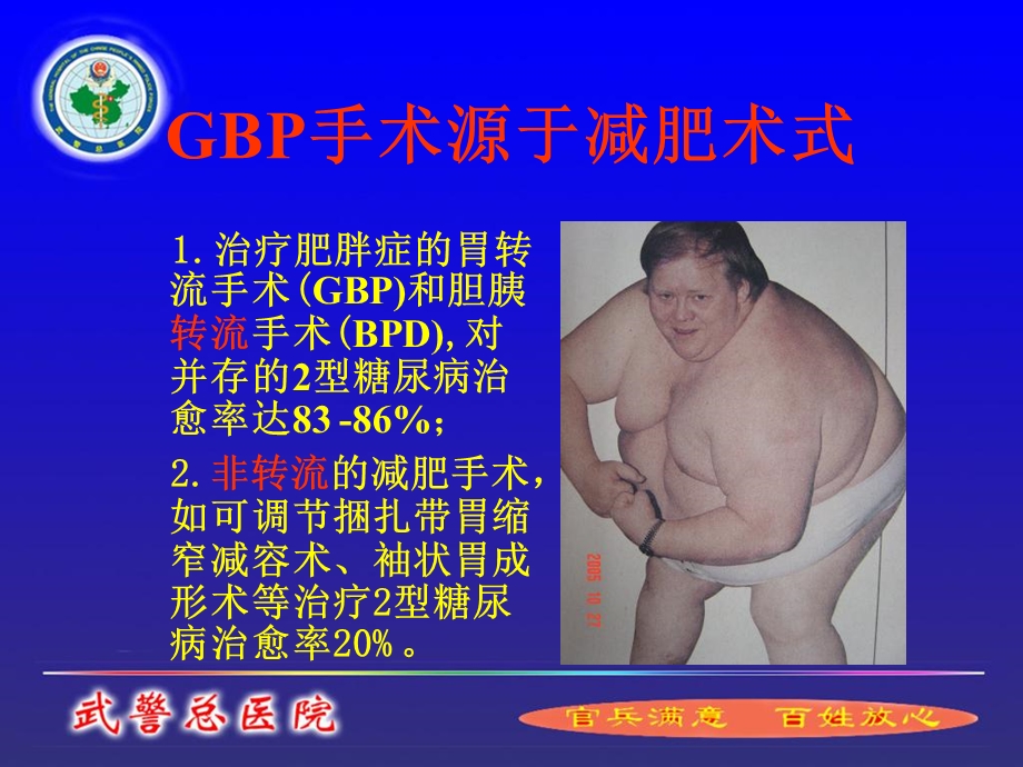 手术治疗糖尿病.ppt_第2页