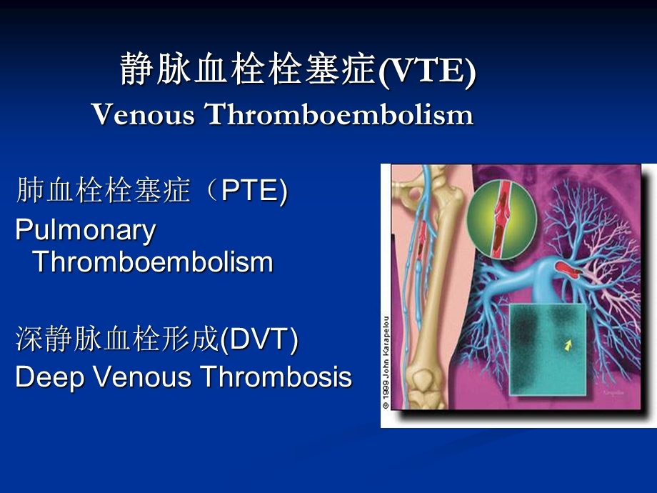 急性肺栓塞的临床诊治.ppt_第2页