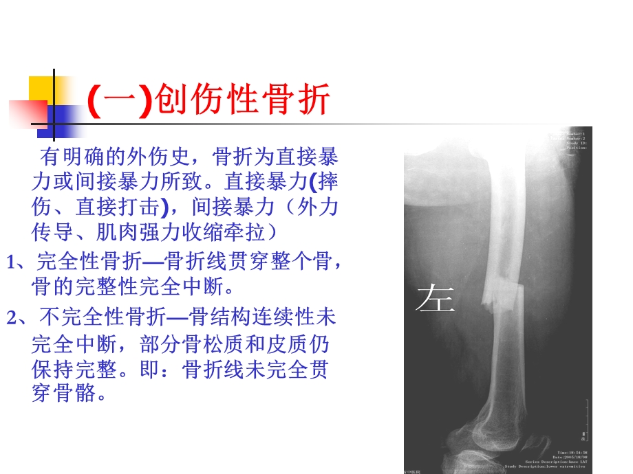 教学课件：第四章、骨关节损伤.ppt_第3页