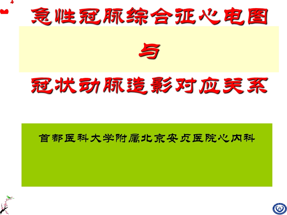 急性心肌梗死心电图与冠状动脉造影对应关系.ppt_第1页