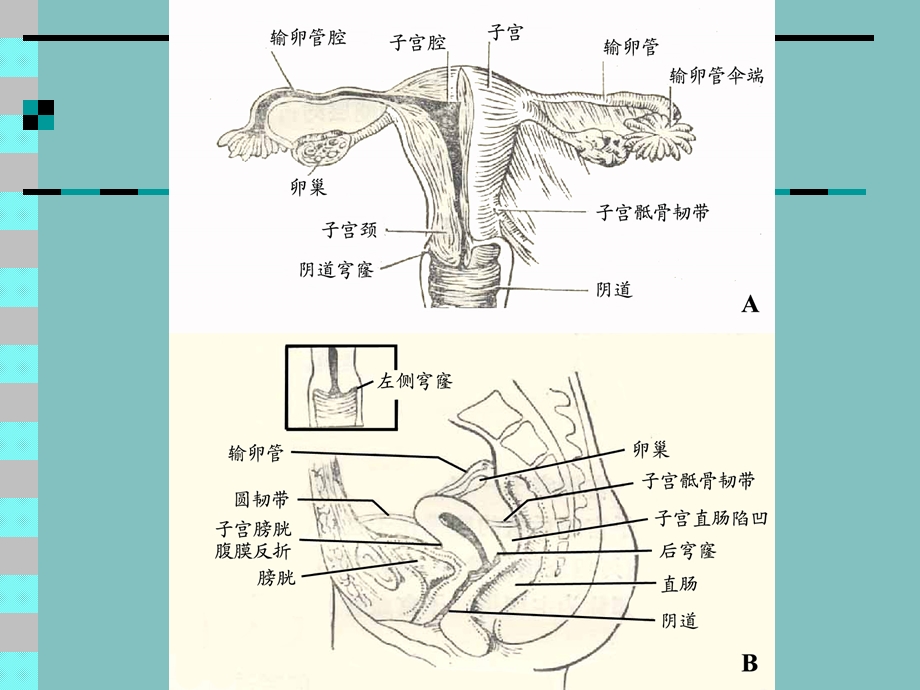 女性生殖系统影像诊断.ppt_第2页