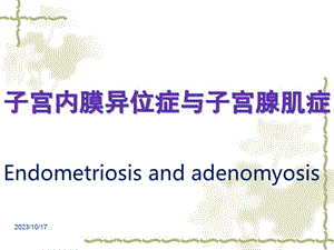 培训资料完成子宫内膜异位症.ppt