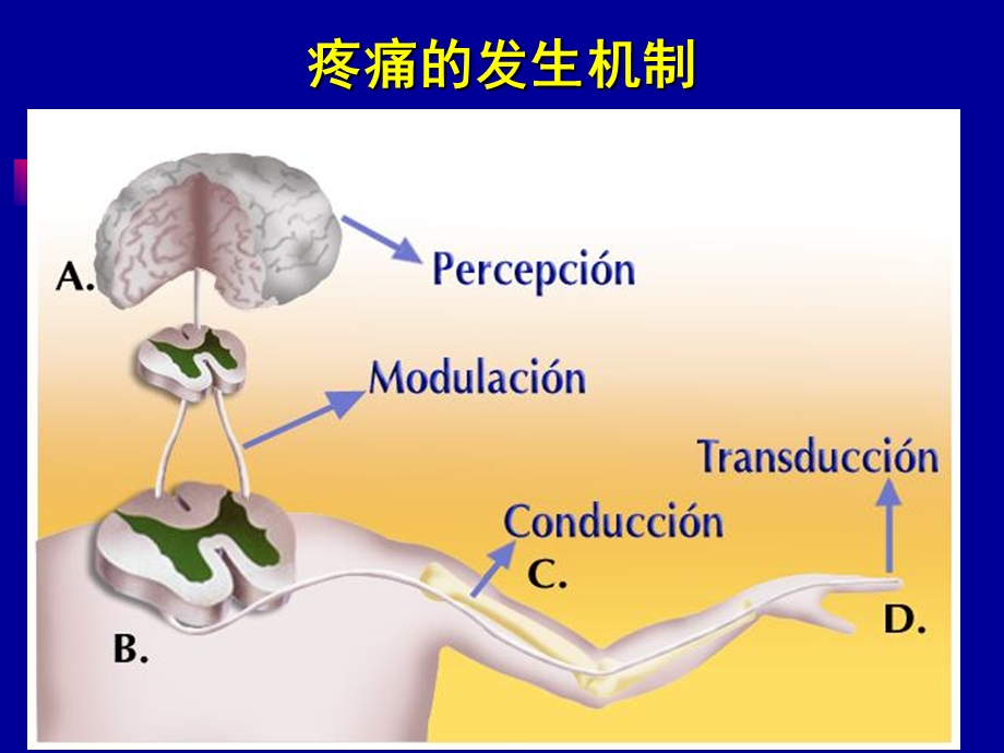 疼痛诊疗学第六章微创介入治疗.ppt_第3页