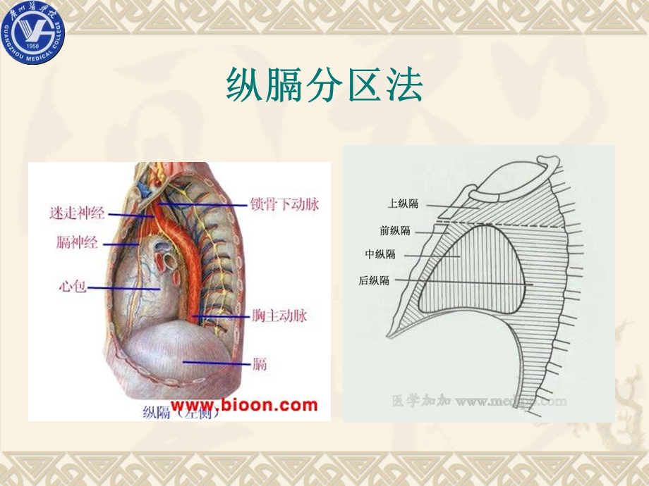 影像诊断学教学资料 纵隔肿瘤、囊肿及肿瘤样病变影像诊断.ppt_第3页