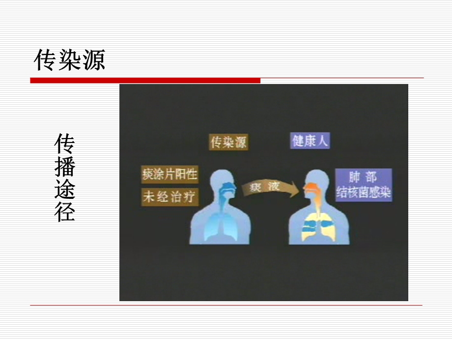 结核病与糖尿病ppt课件.ppt_第3页