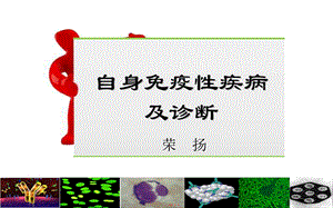 身免疫性疾病及诊断.ppt