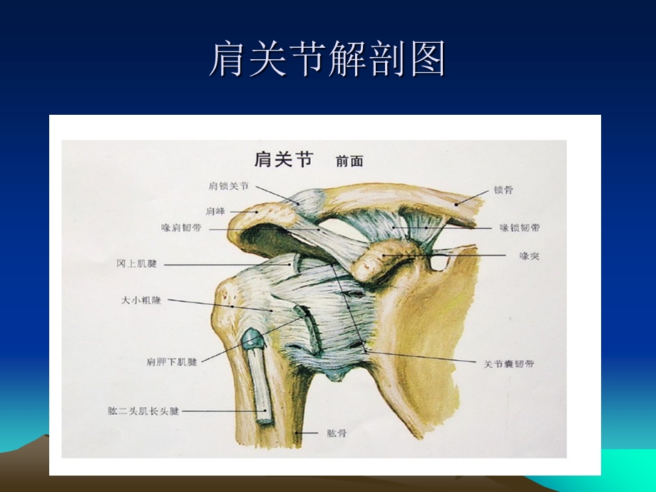 肩关节镜的护理查房课件.ppt_第3页