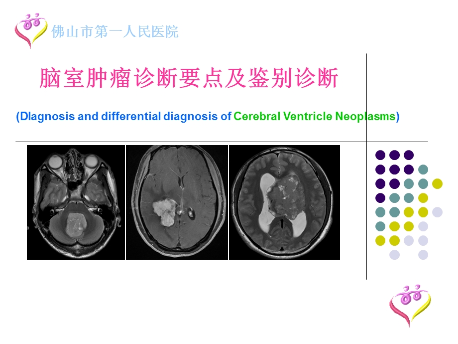 脑室肿瘤诊断要点及鉴别诊断.ppt_第1页