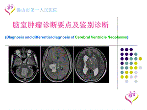 脑室肿瘤诊断要点及鉴别诊断.ppt