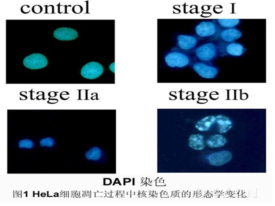 细胞核结构示意.ppt_第1页