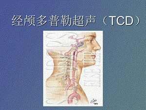 经颅多普勒超声.ppt