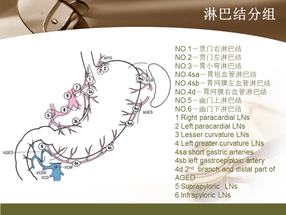 胃癌淋巴结转移CT阅片及相关知识点-陈开波.ppt_第2页