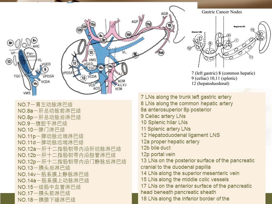 胃癌淋巴结转移CT阅片及相关知识点-陈开波.ppt_第3页