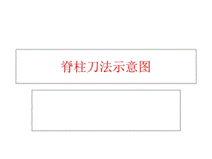 脊柱刀法示意图.ppt