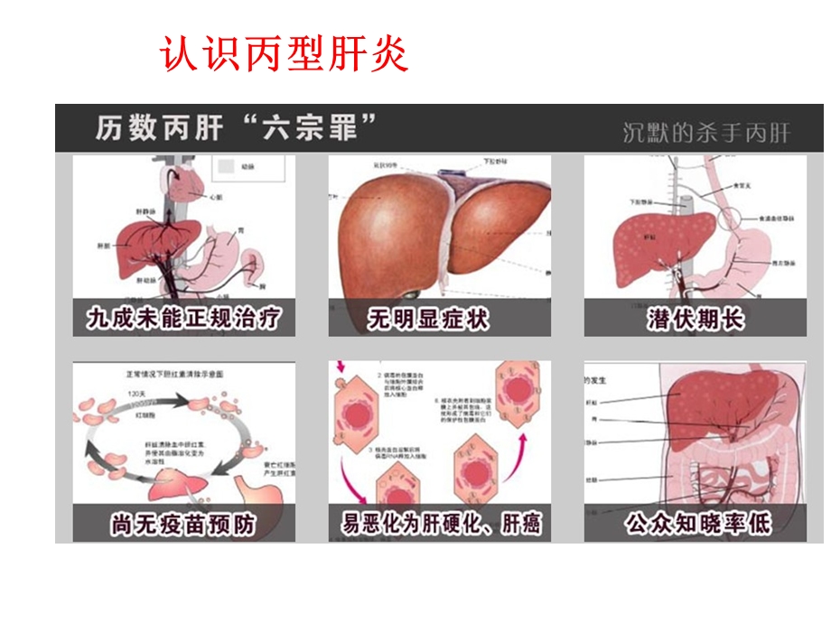 肝病公益科普之丙肝知识.ppt_第2页