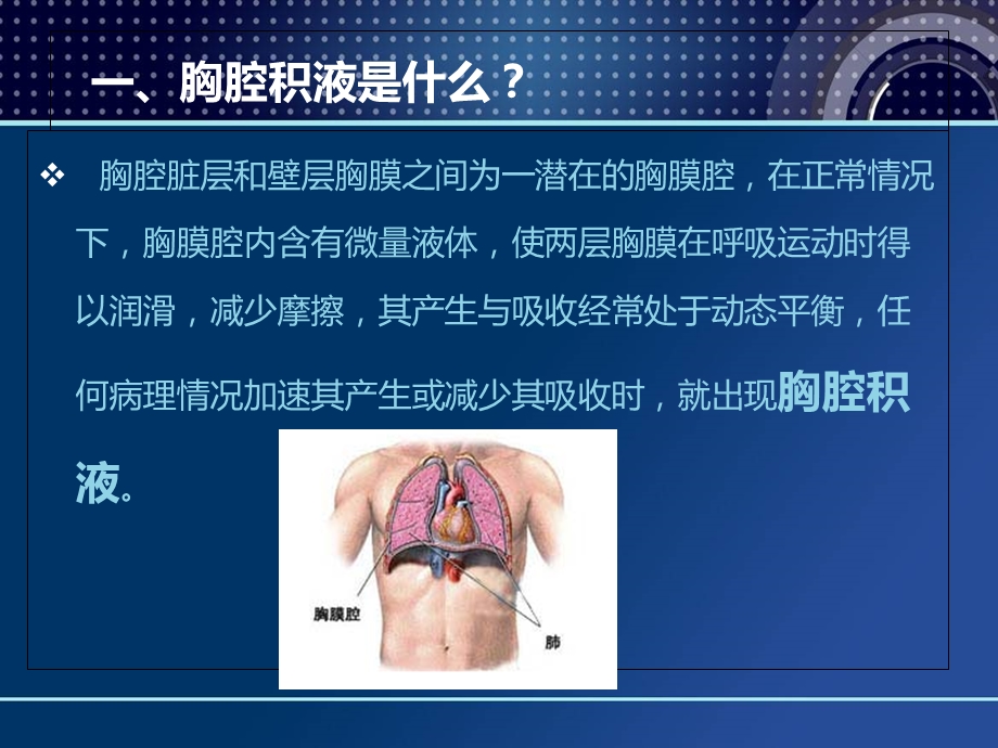 胸腔积液的症状及治疗.ppt_第3页