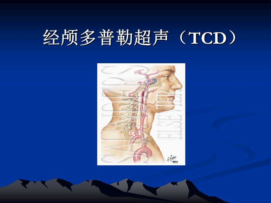 经颅多普勒TCD讲解.ppt_第1页