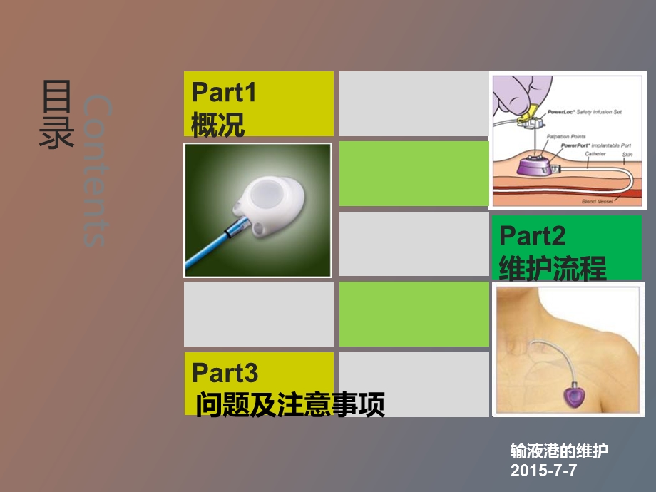 输液港的维护.ppt_第2页