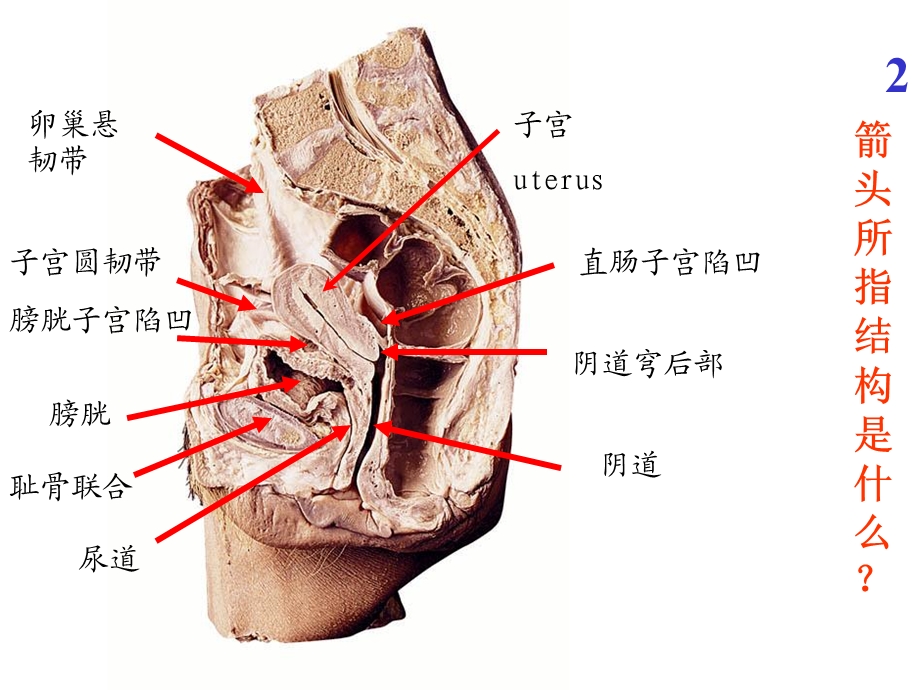 解剖图片考试.ppt_第2页