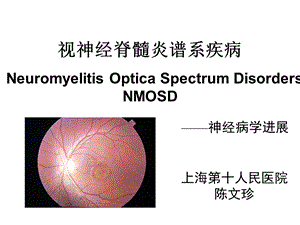 视神经脊髓炎谱系疾病陈文珍.ppt