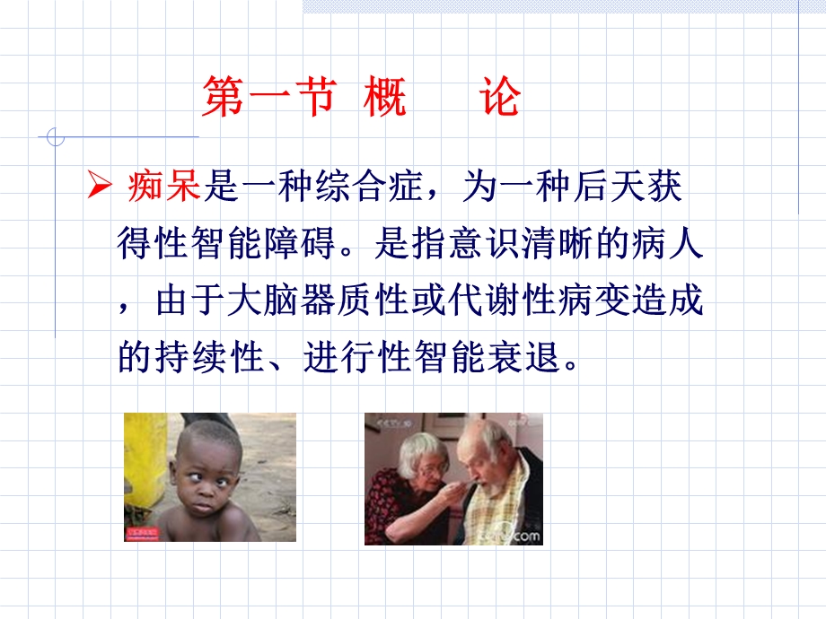 抗老年痴呆药精讲.ppt_第3页