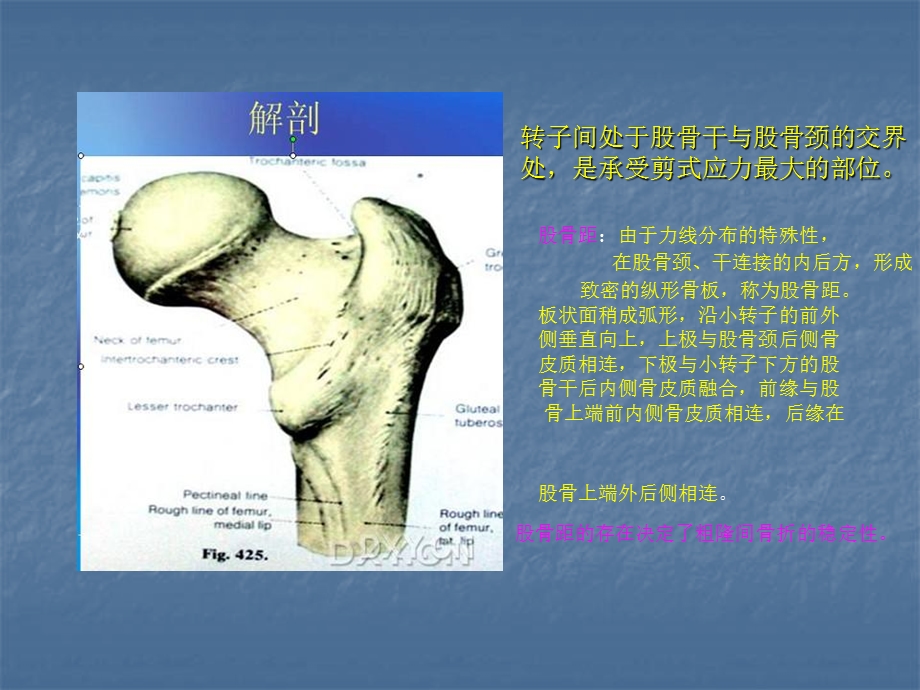 股骨转子间骨折的分型与治疗.ppt_第2页