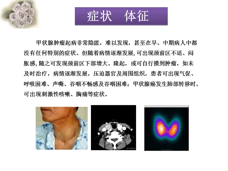 甲状腺肿瘤的围手术期护理ppt课件.ppt_第3页