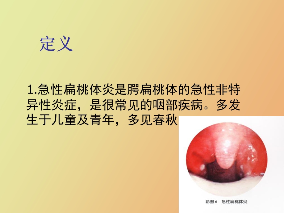 急性扁桃腺炎.ppt_第2页