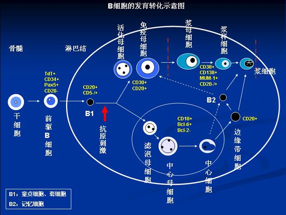 淋巴瘤病理诊断中的抗体选择-JPG-1周小鸽.ppt_第3页