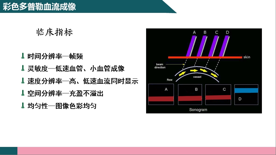 彩色多普勒超声成像原理.ppt_第3页