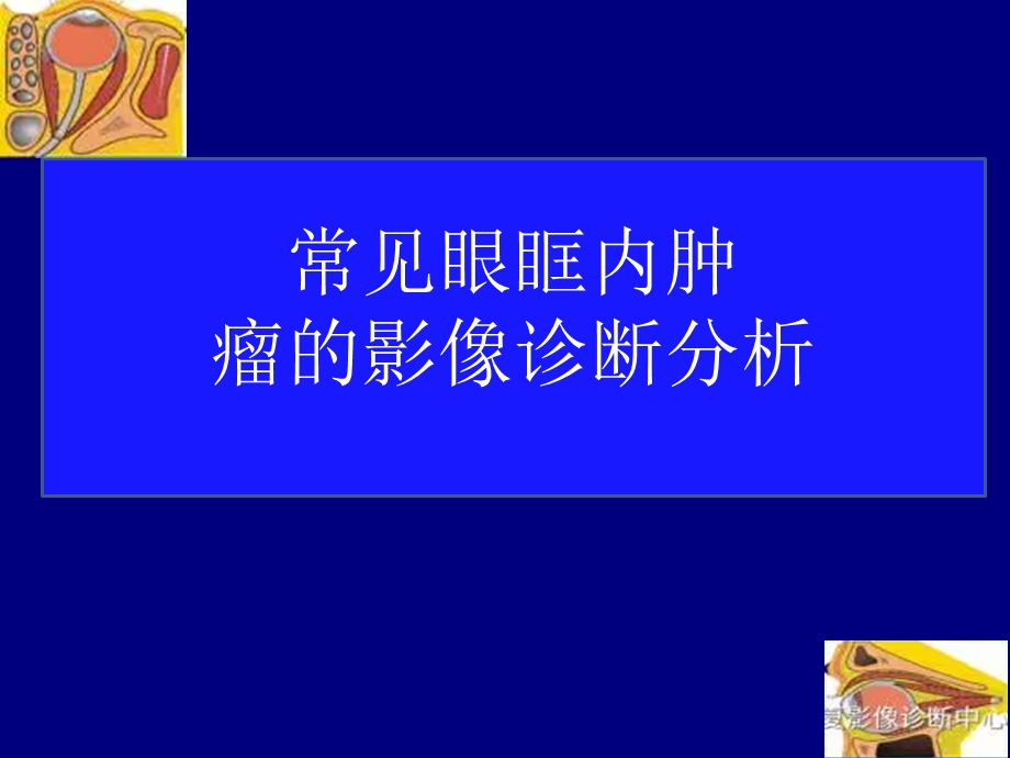 常见眼眶内肿瘤的影像诊断分析.ppt_第1页