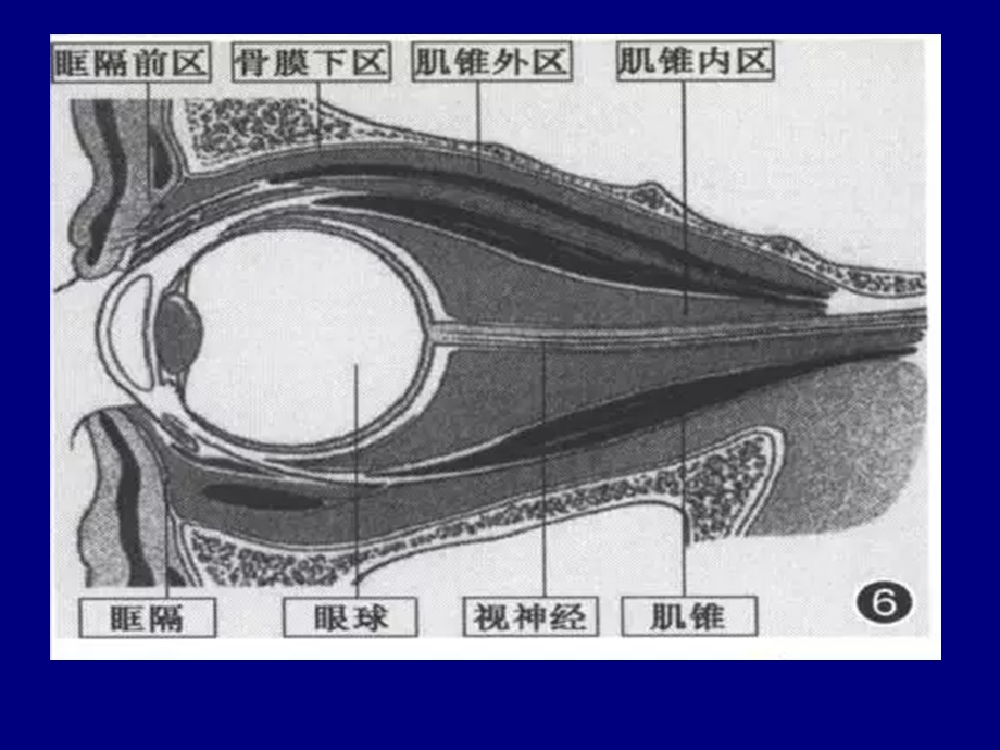 常见眼眶内肿瘤的影像诊断分析.ppt_第3页