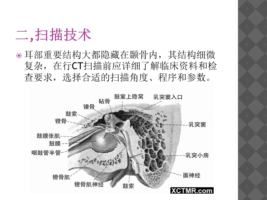 耳部CT扫描技术.ppt_第3页