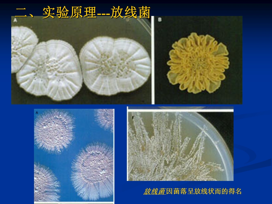 放线菌、霉菌、酵母菌的形态观察.ppt_第3页