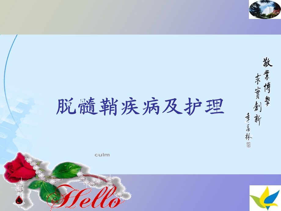 脱髓鞘病及护理.ppt_第1页