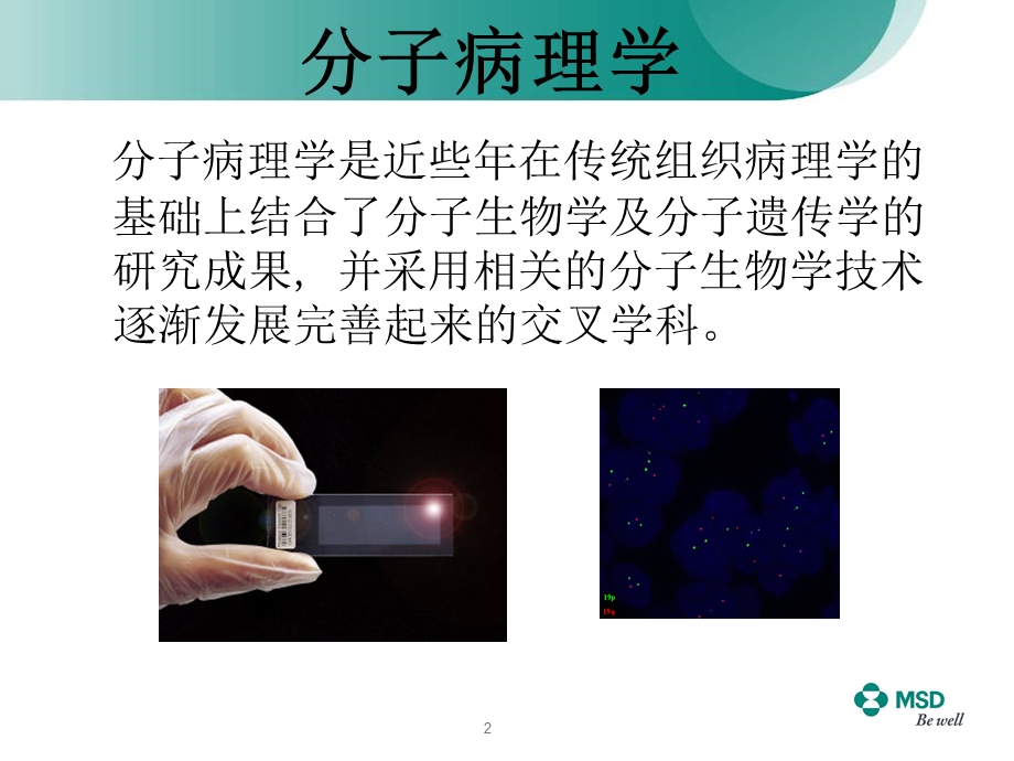 胶质瘤分子学生物标记物.ppt_第2页