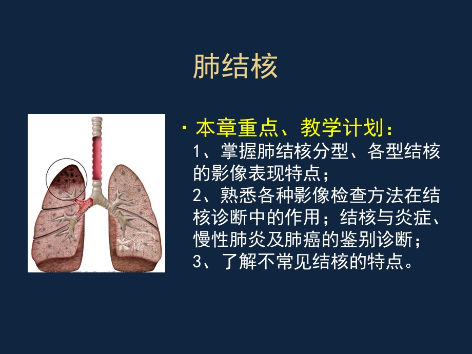 肺结核CT表现.ppt_第3页