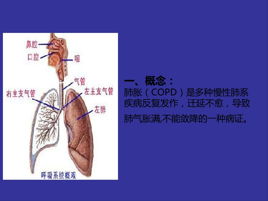 肺胀中医护理查房.ppt_第2页